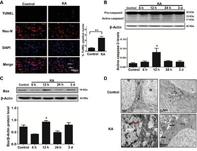 Inhibition of TRIB3 Protects Against Neurotoxic Injury Induced by Kainic Acid in Rats